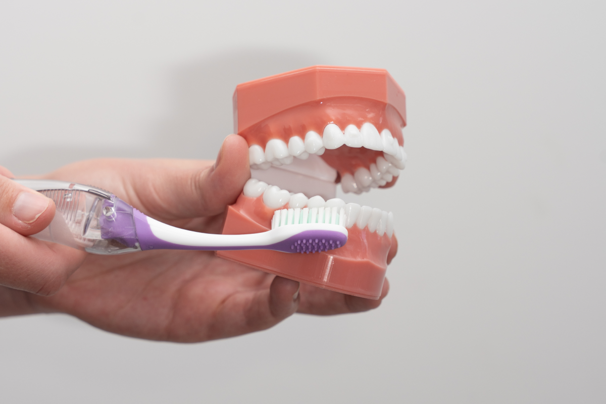 Pilier Slow : bénéfices des aligneurs in-office pour le cabinet